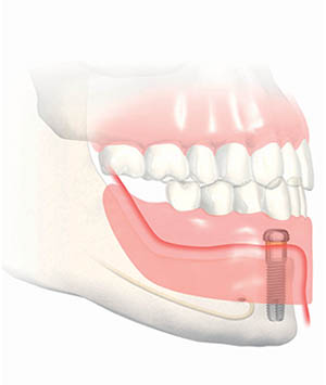 Dentiste Blagnac